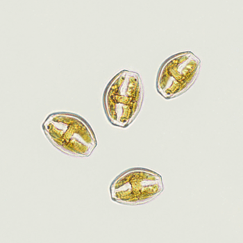 微分干渉観察のイメージ